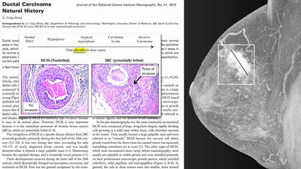 Breast Cancer Survival and Lignan Intake
