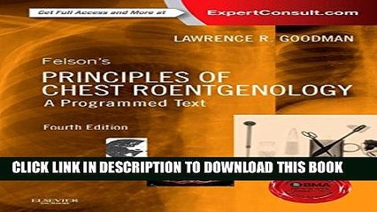 Master Chest X-Rays with Felson’s Principles 📖 – Online Programmed Text