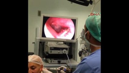 Antalya Kulaklarından Canlı Kene ve Arı Çıktı