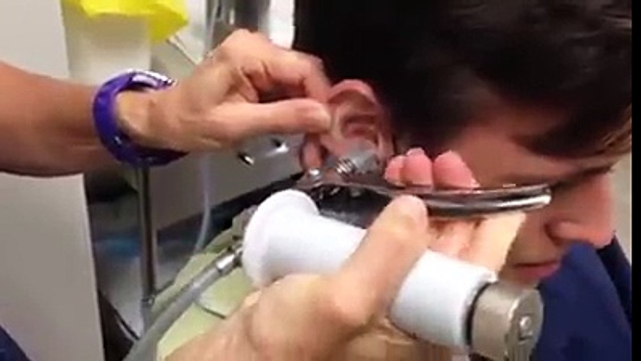The doctor did this to her ear and look at what came out!