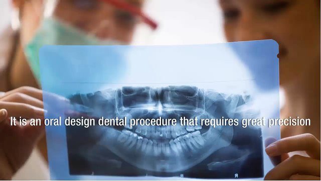Reasons To Get Veneers From A Leading Aesthetic Dental Clinic