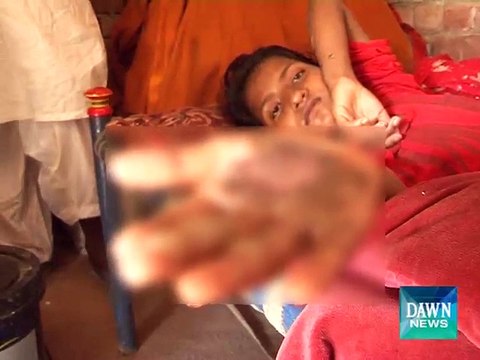 11 year Shazia_ victim by his owner rescued by Child Protection Bureau- DAWN News Report