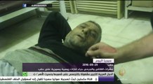 سوريا اليوم - مستشفيات حلب تعلن عجزها عن استقبال المزيد من الجرحى