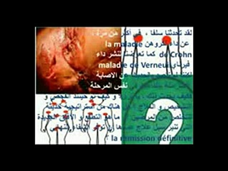 CROHN ET VERNEUIL en association