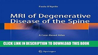 [PDF] MRI of Degenerative Disease of the Spine: A Case-Based Atlas Full Online