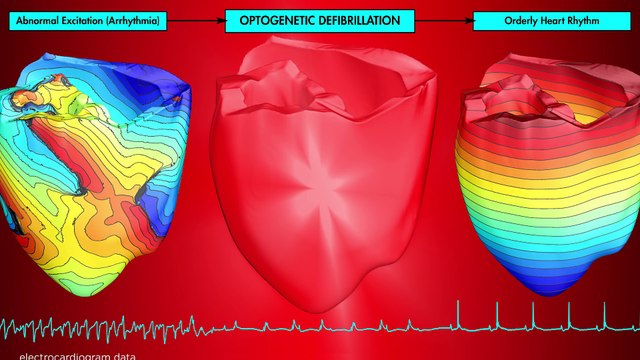 Desfibrilación óptica, según los investigadores de la Universidad Johns Hopkins