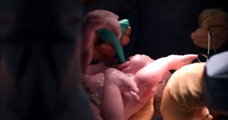 3 Farklı Ebeveynin DNA'sına Sahip İlk Bebek Dünyaya Geldi