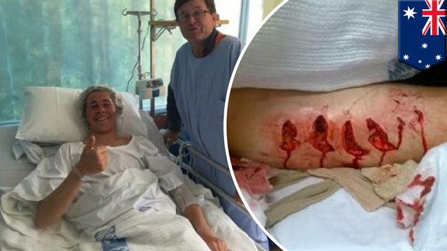 Shark attack: Great white mauls Australian teen surfer near half-built shark barrier - TomoNews