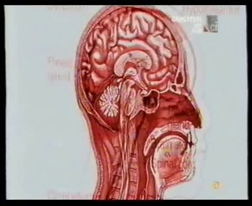Alcoholismo cronico (Atrofia cerebelosa): Autopsia forense