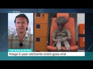 The War In Syria: Images of child victim of bombing spark outrage, Ediz Tiyansan reports