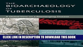New Book The Bioarchaeology of Tuberculosis: A Global View on a Reemerging Disease