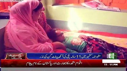 11 Years old Kashmiri girl lose vision due to pellet gun