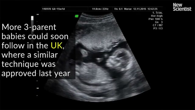 Nacimiento de bebé con ADN de tres personas abre puertas a nuevos tratamientos
