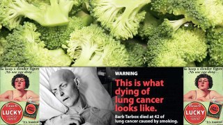 Lung Cancer Metastases and Broccoli