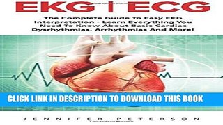 [PDF] Ekg | Ecg: The Complete Guide To Easy EKG Interpretation - Learn Everything You Need To Know