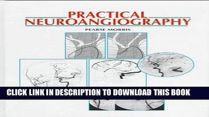 [PDF] Practical Neuroangiography Full Colection