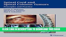 [PDF] Spinal Cord and Spinal Column Tumors: Principles and Practice Full Colection