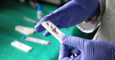 İngiliz Bilim Adamları AIDS'li Hastayı İyileştirdi