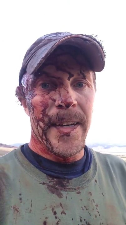 Un chasseur se filme après avoir été attaqué par un ours