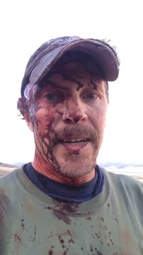 Un chasseur se filme après avoir été attaqué par un ours