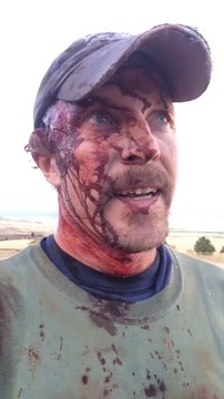 Chasseur filmé en sang après un combat avec un ours