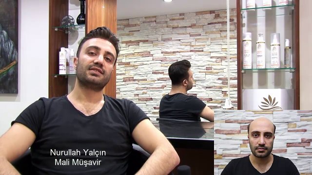 Protez Saç Kullananlar