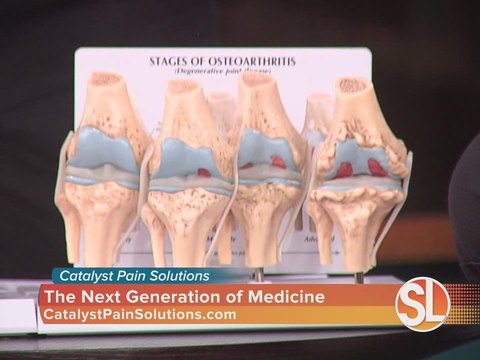 Catalyst Pain Solutions, formerly AZ Pain Centers, treats osteoarthritis