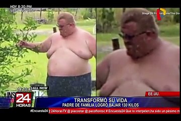 EEUU: hombre logra perder 133 kilos en año y medio de tratamiento