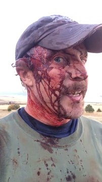 Il se filme en sang après s'être battu contre un ours