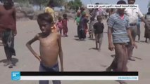 أطفال يمنيون يعانون الجوع
