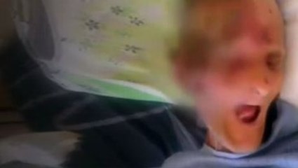 Antalya'da Huzurevinde Skandal Görüntüler! Yaşlıların Hali İçler Acısı