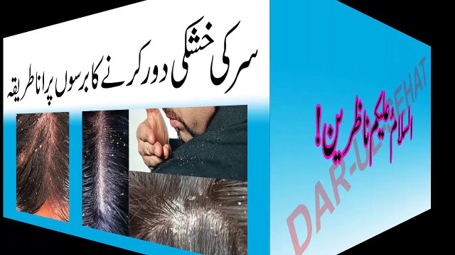Dandruff Treatment in urdu | Sar Ki Khushki Door Karne Ka ilaj in Urdu |Hair Dandruff Remove in urdu