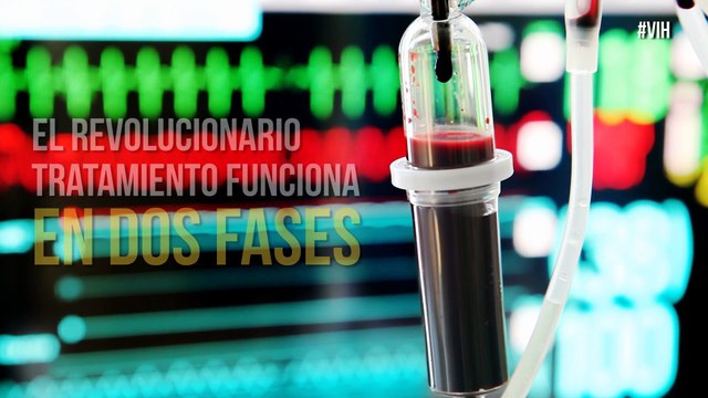 Esperanzador: Científicos británicos cada vez más cerca de encontrar la cura del VIH