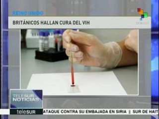 Científicos del Reino Unido hallan posible cura contra el VIH
