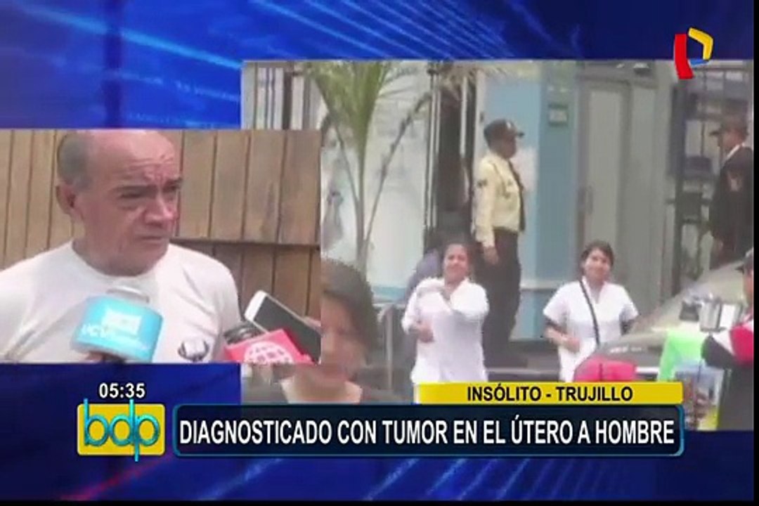 Trujillo: por error diagnostican con tumor en el útero a hombre