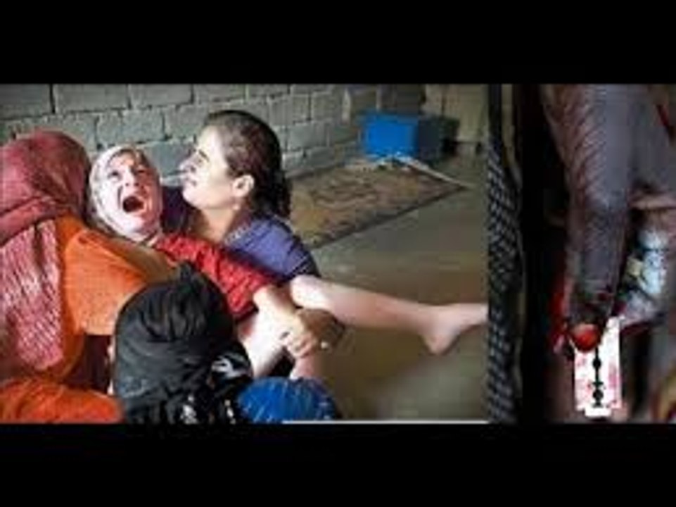 ছেলেদের নয় মেয়েদের যেভাবে মুসলমানি করা হয় জানলে চমকে উঠবে