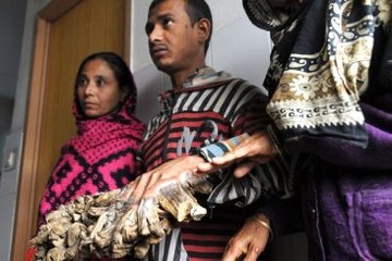 Ağaç Adam İlk Defa Kendi Kendine Yemek Yedi