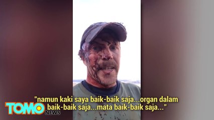 Download Video: Lelaki diserang beruang, pergi sendiri ke rumah sakit - Tomonews