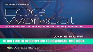 [Read PDF] ECG Workout: Exercises in Arrhythmia Interpretation Ebook Online