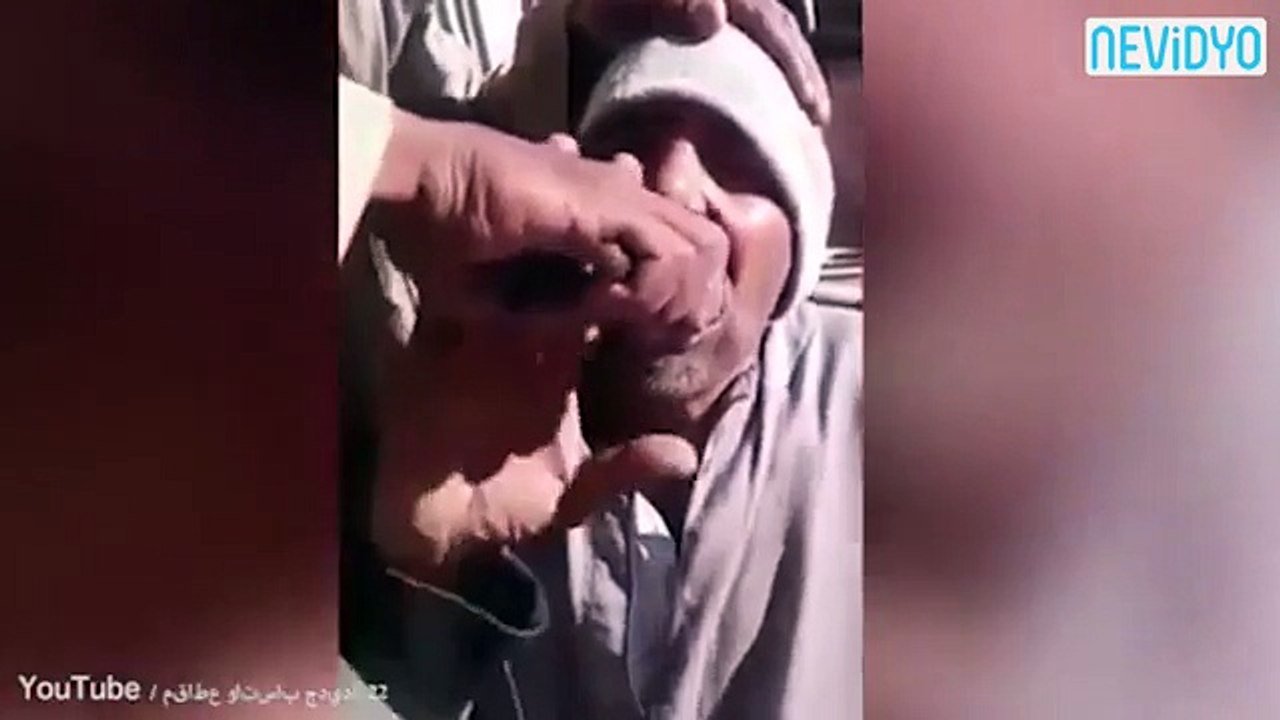 Bu görüntüler, dişçiye gitmeye tövbe ettirecek!