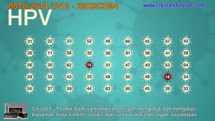 Wanita Wajib Tahu !!! Gejala Kanker Serviks Dan Penyebabnya, Cara Mencegah Dan Mengobatinya