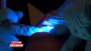 Patrick Clark gets his chipped tooth fixed: WWE NXT Exclusive, Oct. 6, 2016