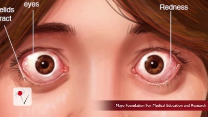 What Your Eyes Could Be Saying About Your Health