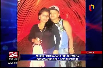 Comas: mujer embarazada fue quemada por su pareja