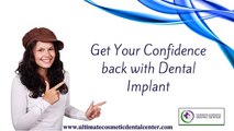 Dental Implants Bangalore | Dental Clinic India
