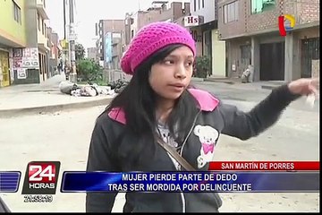 SMP: mujer pierde parte del dedo tras ser mordida por delincuente