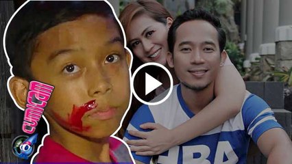 Abi Berdarah, Shanty dan Ibunda Denny Cagur Cemas - Cumicam 12 Oktober 2016