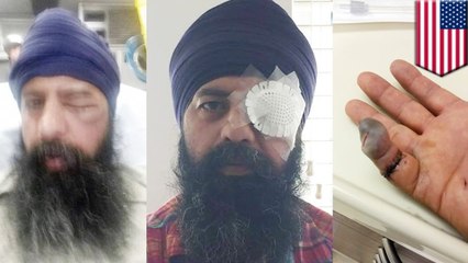 Sikh man’s hair cut off during brutal assault in California