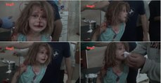 Menina ferida procura em desespero pelo pai após bombardeamento na Síria
