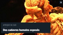 En Afrique du sud, des cadavres humains exhibés dans un musée.